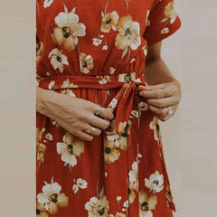 Casual Print Round neck Short sleeve Lacing Skater Dresses